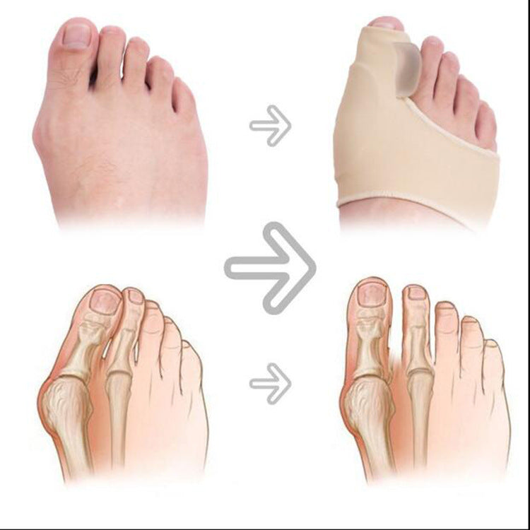 Big Foot Valgus Corrector Wear Protective Cover Büyük Ayak Valgus Düzeltici Koruyucu Kılıf