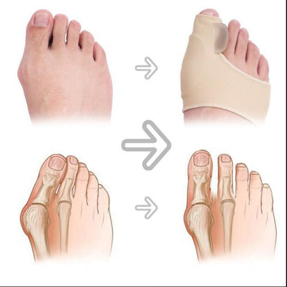 Big Foot Valgus Corrector Wear Protective Cover Büyük Ayak Valgus Düzeltici Koruyucu Kılıf